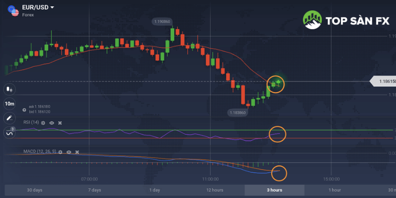 MACD 3